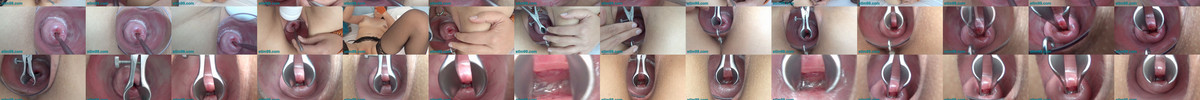 _Stim99 Presents Open cervix with speculum and semen insertion in uterus.mp4 screencaps